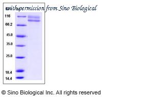 Sino Biological 11747-H02H image 1