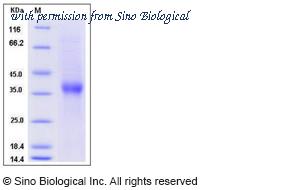 Sino Biological 10773-H07H image 1
