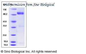 Sino Biological 11609-H01H2 image 1