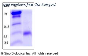 Sino Biological 12183-HNCE image 1