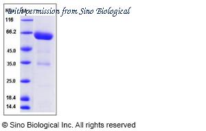 Sino Biological 13499-H02H image 1