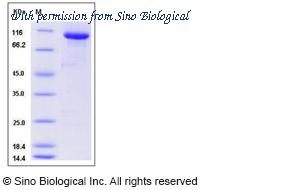 Sino Biological 50994-M02H image 1