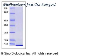 Sino Biological 10163-H07E image 1