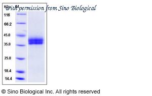 Sino Biological 50919-M08H image 1