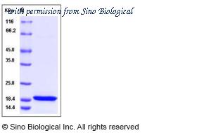 Sino Biological 10997-H07E image 1