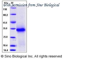 Sino Biological 50162-M08H image 1