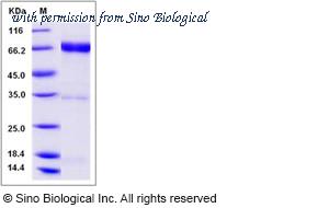 Sino Biological 11609-H04H image 1