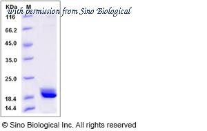 Sino Biological 13896-H07E image 1