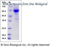 Sino Biological 13124-H01H image 1