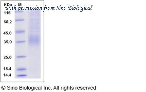 Sino Biological 80166-R07H image 1