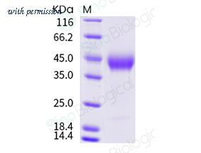 Sino Biological 11609-HNCH image 1