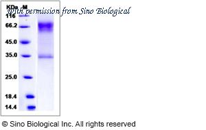 Sino Biological 13365-H02H image 1