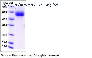 Sino Biological 13735-H08H image 1