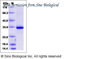 Sino Biological 14252-H07E image 1