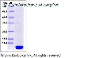 Sino Biological 14561-H07E image 1