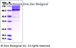 Sino Biological 50766-M02H image 1