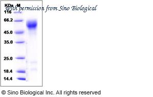 Sino Biological 10126-HCCH image 1