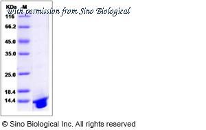 Sino Biological 13796-H07E image 1