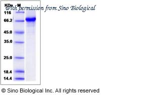 Sino Biological 14461-H20B image 1