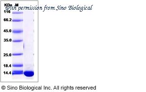 Sino Biological 14483-H07E image 1