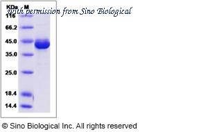 Sino Biological 14565-H20B image 1