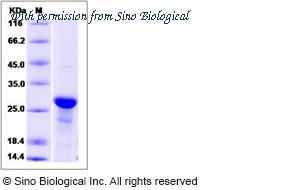 Sino Biological 14005-H07E image 1