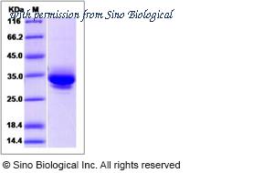 Sino Biological 13152-HCCH image 1