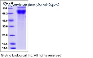 Sino Biological 50328-M02H image 1