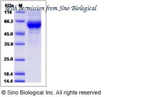 Sino Biological 51049-M02H image 1