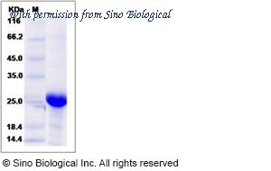 Sino Biological 14497-H07E image 1
