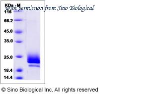 Sino Biological 15682-H08H image 1