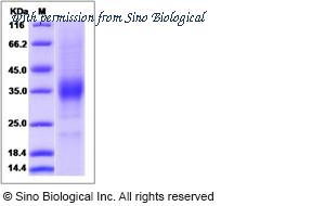 Sino Biological 13052-HCCS image 1