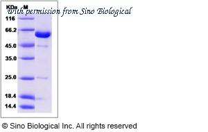 Sino Biological 15669-HNCB image 1