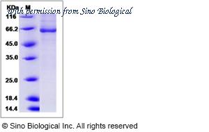 Sino Biological 15675-H20B image 1