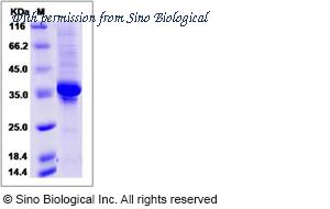 Sino Biological 13971-H05H image 1