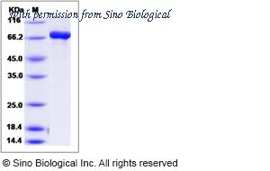 Sino Biological 14884-H20B image 1