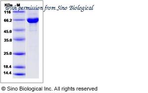 Sino Biological 14914-H20B image 1