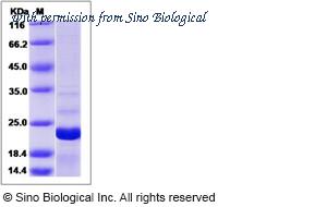 Sino Biological 14927-H07E image 1