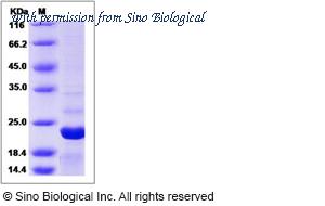 Sino Biological 14967-H07E image 1