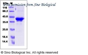 Sino Biological 13894-H05H image 1