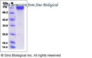 Sino Biological 13969-H08H image 1