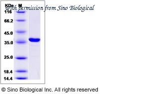 Sino Biological 14625-H07E image 1