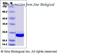 Sino Biological 14934-H07E image 1