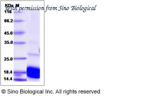 Sino Biological 13816-H07E image 1
