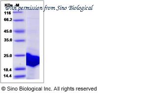 Sino Biological 14004-H07E image 1