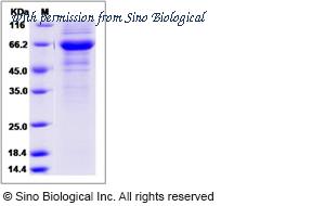 Sino Biological 13556-H02H image 1