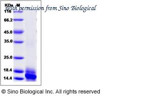 Sino Biological 10360-H07E image 1