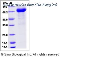 Sino Biological 13757-H02H image 1