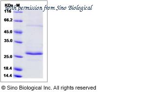 Sino Biological 16007-HNCH image 1