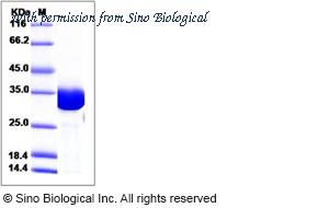 Sino Biological 15242-H07E image 1